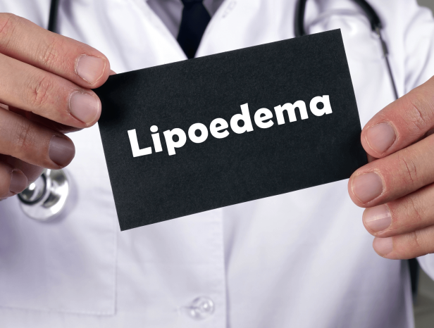 Lipoedema-Images-4-1 Lipoedema-Images-4-1