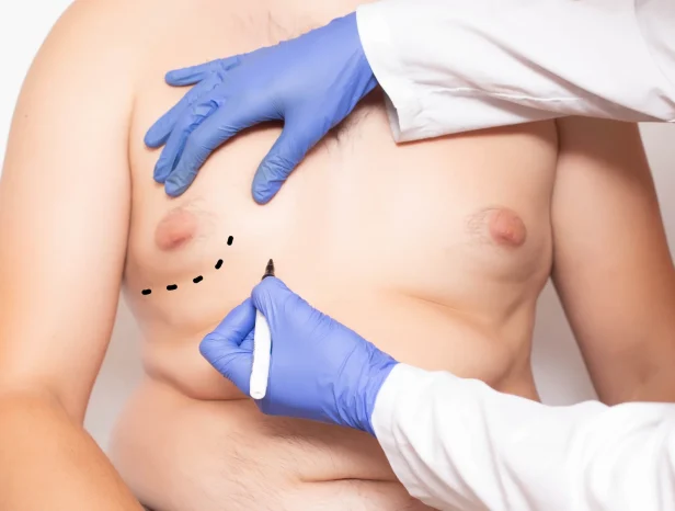 Website-Pictures-52-Gynecomastia-Personalized-Treatment-Planning Website-Pictures-52-Gynecomastia-Personalized-Treatment-Planning
