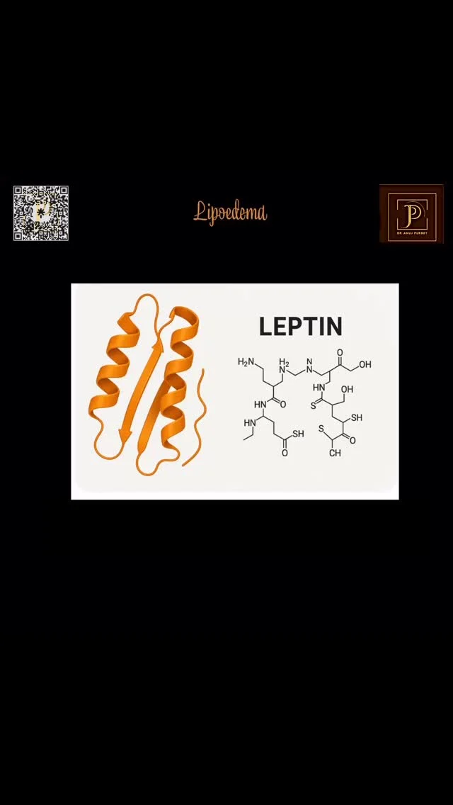 Leptin resistance may worsen Lipoedema by making fat loss harder and increasing inflammation. While it doesn’t cause Lipoedema directly, it can interfere with symptom management.

⚠️ Note: These tips are for otherwise healthy individuals. If you have conditions like diabetes, thyroid issues, or autoimmune disease….consult your doctor before making lifestyle changes.

✅ Ways to Support Leptin Sensitivity
1. Anti-inflammatory diet
2. Intermittent fasting
3. Strength training + movement
4. Prioritise 7–9 hrs sleep
5. Reduce stress (yoga, breathwork)
6. Support gut health (probiotics & fibre)
7. Check nutrients: Zinc, Magnesium, Vitamin D, Omega-3

Advanced Options - Under Medical Guidance For resistant cases, your doctor may suggest:
* Low-dose Naltrexone (LDN) – Reduces inflammation and pain
* GLP-1 Agonists (e.g. Semaglutide) – Regulates weight and hormones
* Functional Tests – Identify gut, nutrient, or inflammatory issues

🩺 Clinical Insight Leptin resistance can intensify Lipoedema symptoms. A holistic approach may improve results from treatments like VASER liposuction, compression, and/or lymphatic therapy. Consult Dr. Anuj Purbey for a tailored treatment plan.

#LipoedemaAwareness #LeptinResistance #LipoedemaSupport #lipedema #LipoedemaUK #HormoneHealth #AntiInflammatoryLiving #LeptinReset #VASERLiposuction #dranujkrpurbey  #LymphaticHealth #MetabolicHealth #LipoedemaJourney #WeightLossResistance #LipoedemaTreatment #WomenWithLipoedema #HormonalBalance #LipoedemaClinic #LipoedemaSolutions #FunctionalMedicine #LipoedemaCare